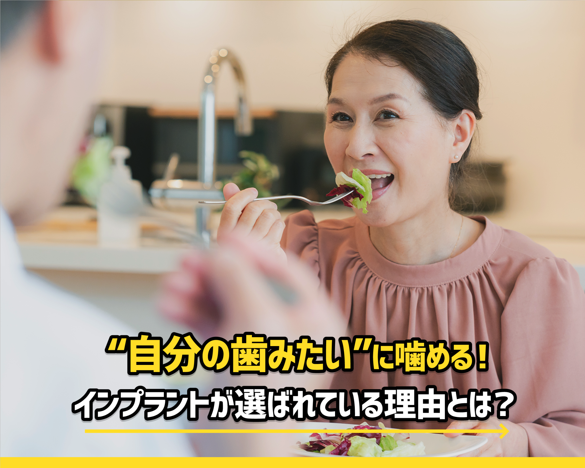 “自分の歯みたい”に噛める！今インプラントが選ばれている理由とは？