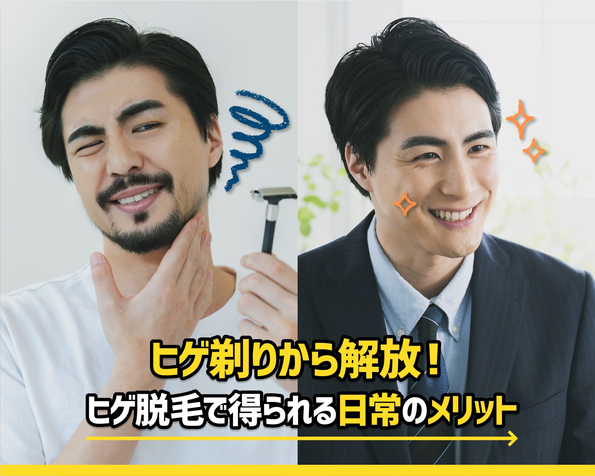 ヒゲ剃りから解放！ヒゲ脱毛で得られる日常のメリット